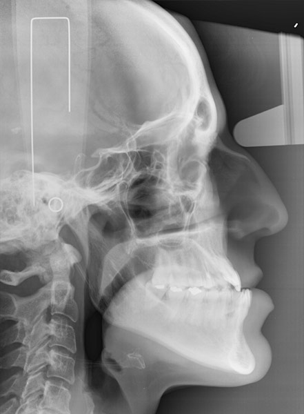CASO_4_radiografia