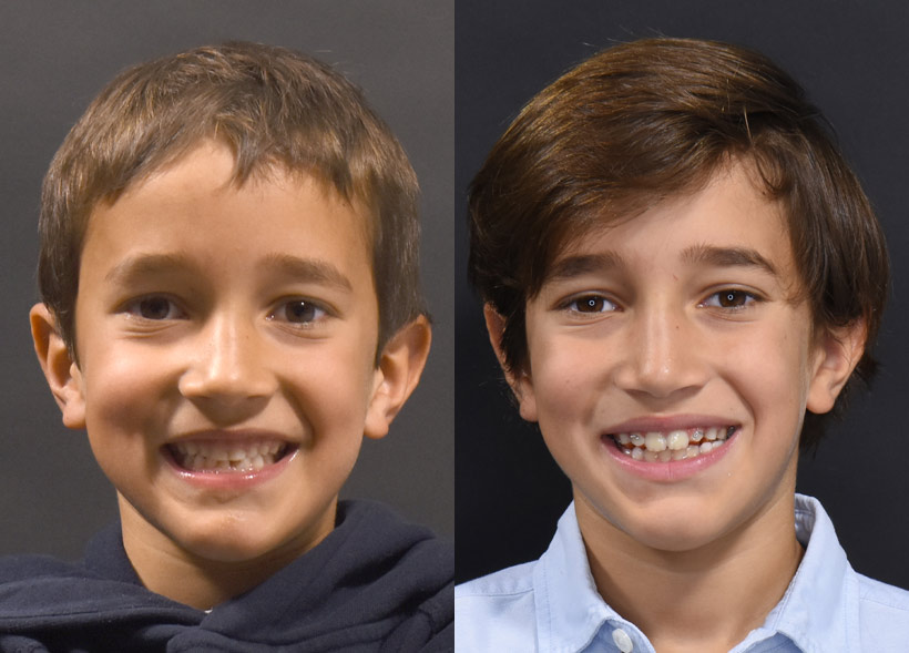 Caso-10_2-fotos-sonriendo